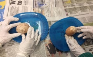 gloved children hands holding two eggs with decaying shells